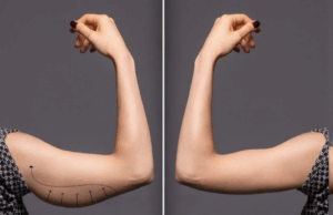 20a3dd95 4148 406d 8628 a0b51155613f