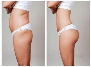 549593ee a9ba 42d7 b0bd a214495a16ce