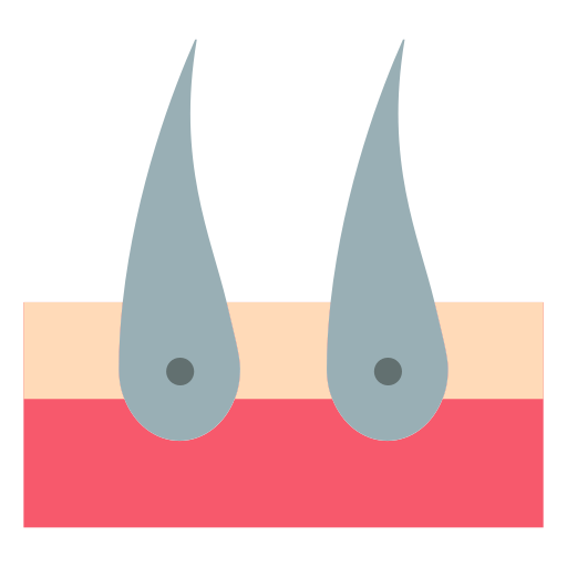 chirurgie capillaire