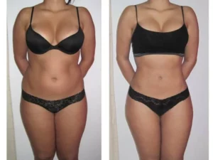 lipo 768x576