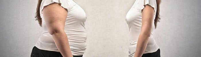 erreurs apres chirurgie bariatrique